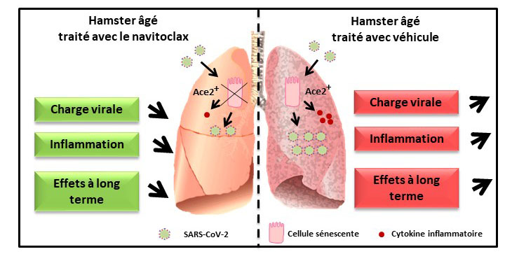 © F. Trottein Figure : Effet du navitoclax (ABT-263) sur l’infection virale au SARS-CoV-2. Chez l’individu âgé, les cellules sénescentes pulmonaires expriment le récepteur au SARS-CoV-2 (Ace 2). L’élimination de ces cellules à l’aide du navitoclax réduit la charge virale. Par ailleurs, la production des facteurs inflammatoires par ces cellules est atténuée. L’inflammation locale est donc réduite ainsi que les effets à long terme.
